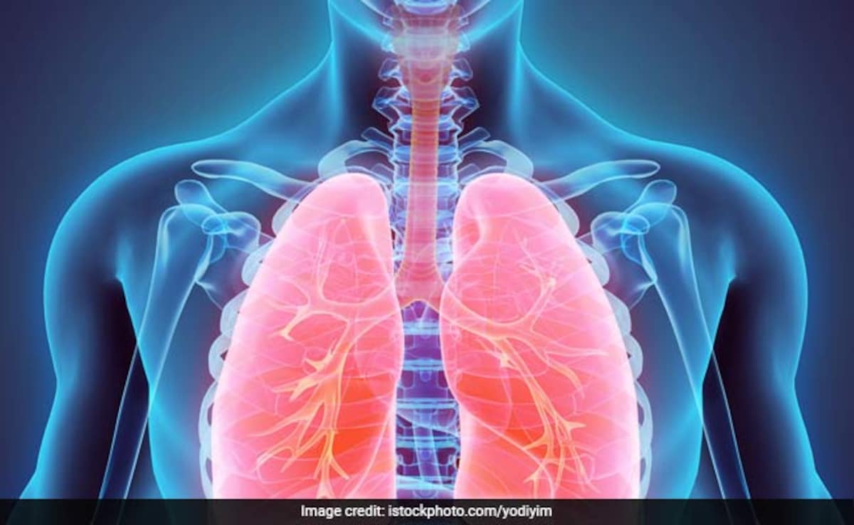 World Lung Day 2025: जानें – फेफड़ों की बीमारी के बारे में, क्या है इसके लक्षण और कारण