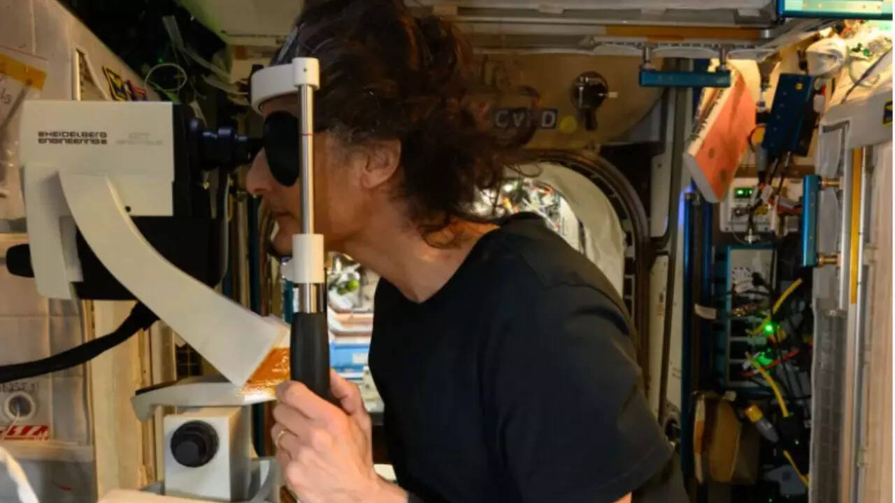 NASA reports shocking vision changes in astronauts after months in space with long-term eye damage risks