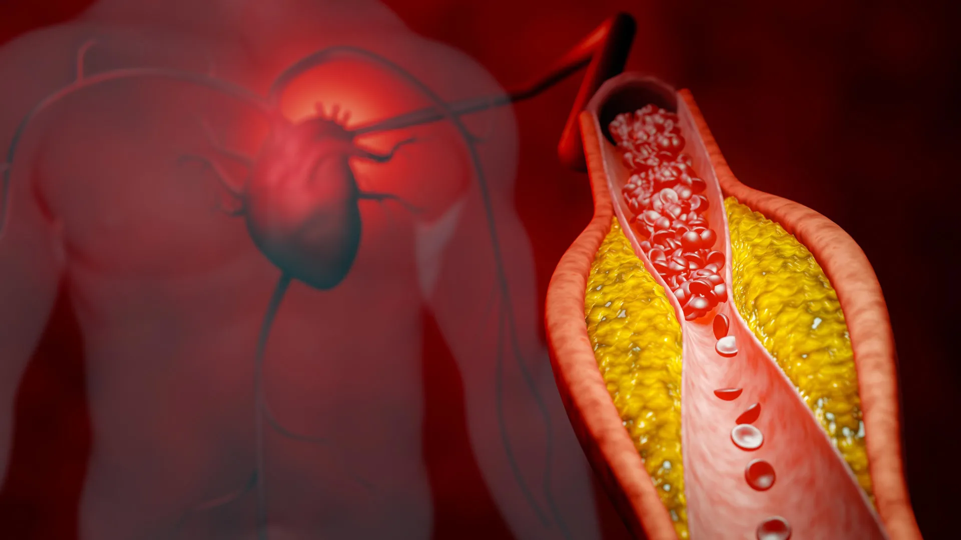 Bharat Journal New treatment cuts bad cholesterol by nearly 50% without statins