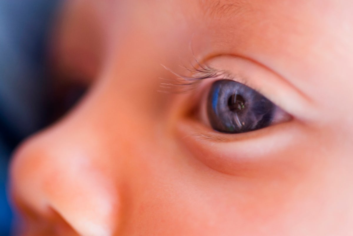Bharat Journal How a vision-restoring gene therapy proved that we can treat inherited diseases