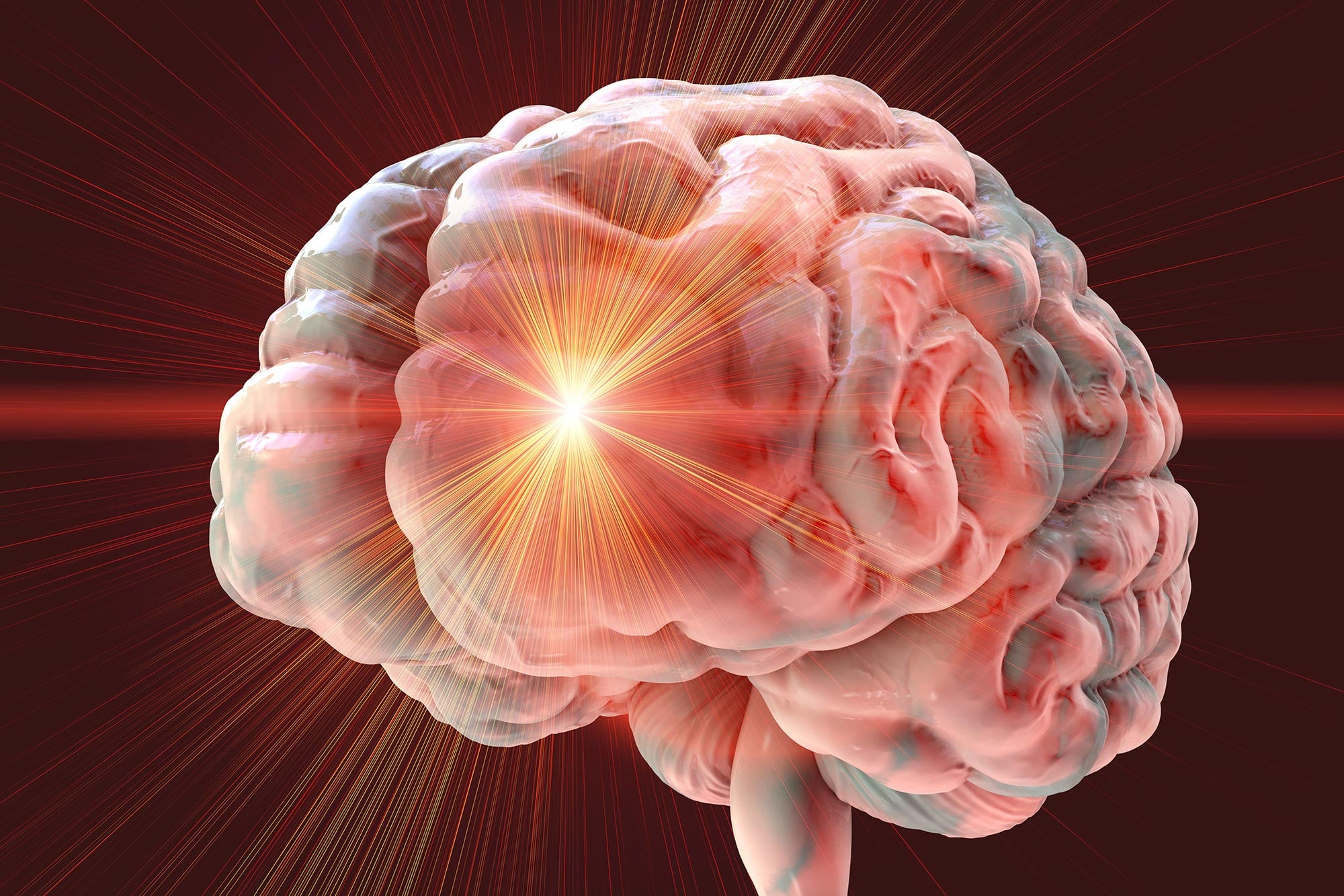 Bharat Journal Scientists Reverse Stroke Damage Using Stem Cells in Breakthrough Study
