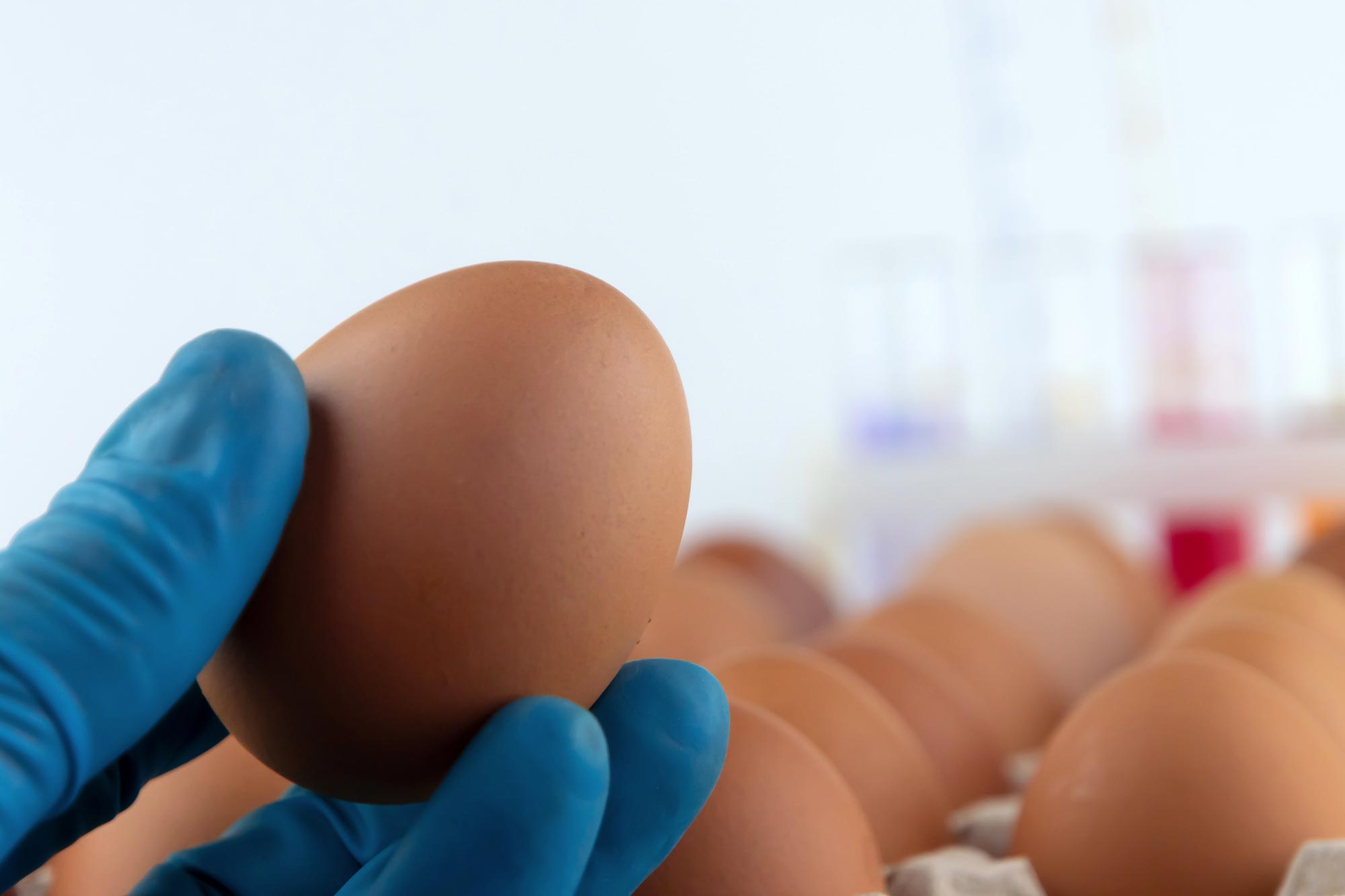 Bharat Journal Eating One Egg a Day Could Cut Alzheimer’s Risk by 27%